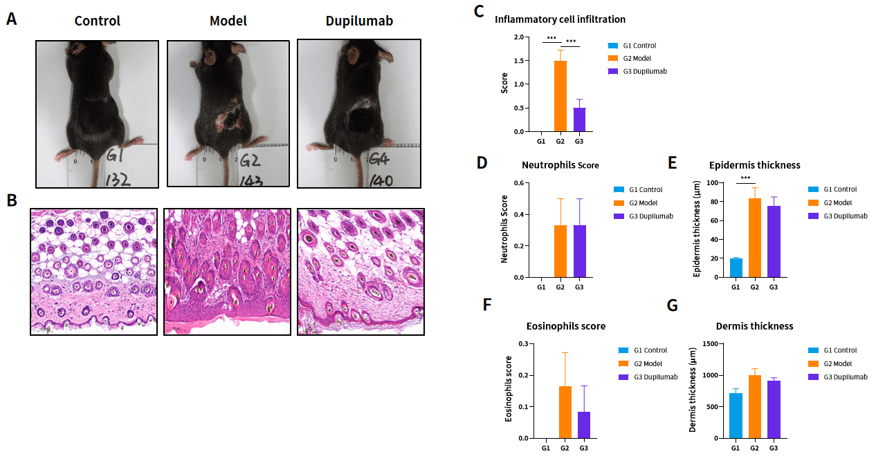 Case 1 Fig.4 Dupilumab significantly mitigates inflammatory cell infiltration in lesioned skin on day 14.