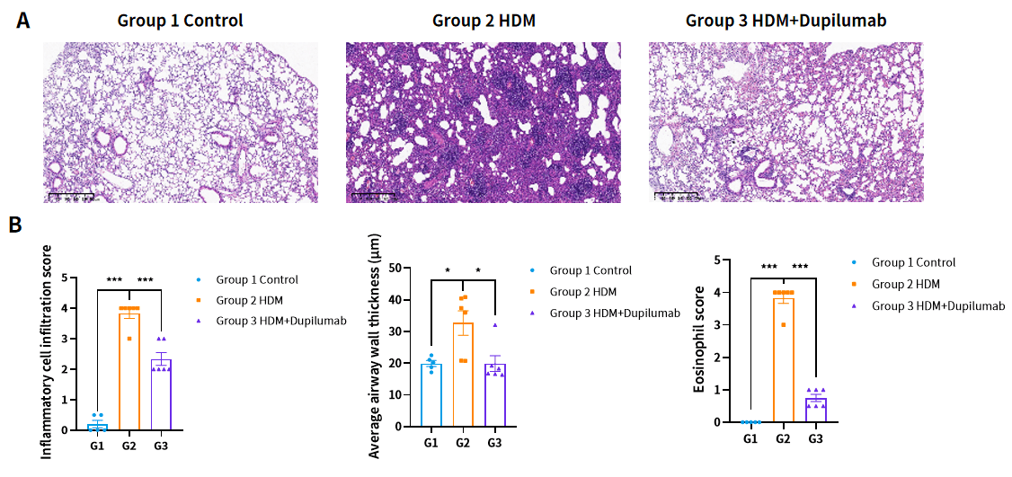 Case 3 Fig.4 Dupilumab significantly mitigates the asthma symptoms in lung.