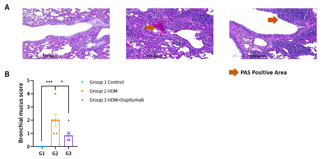 Case 3 Fig.5 HDM induced hIL4/hIL4R mice asthma model PAS staining.